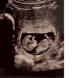 Meet your Posher, Lee